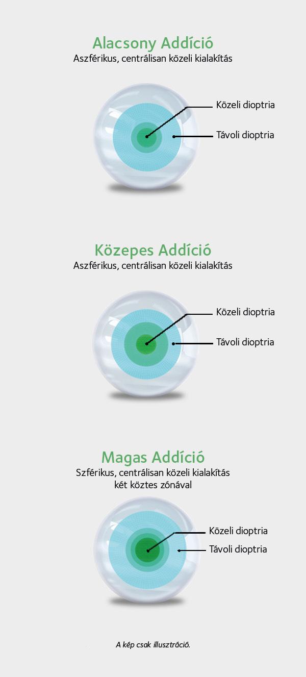 A MyDay multifocal lencse kialakítása