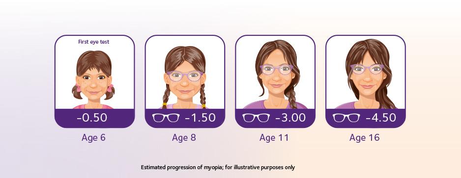 myopia in children myopia in children